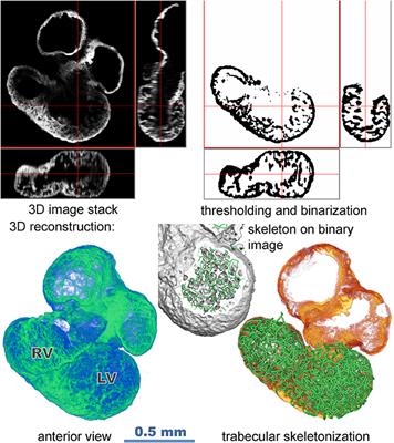 Trabecular Architecture Determines Impulse Propagation Through the Early Embryonic Mouse Heart